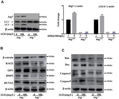 AGEs-Induced Calcification and Apoptosis in Human Vascular Smooth Muscle Cells Is Reversed by Inhibition of Autophagy